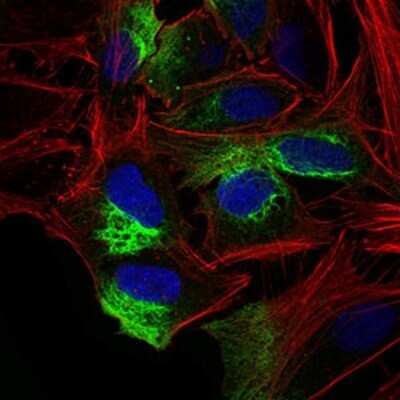 Immunocytochemistry/ Immunofluorescence: ZEB1 Antibody (2A8H3) - BSA Free [NBP2-37329]