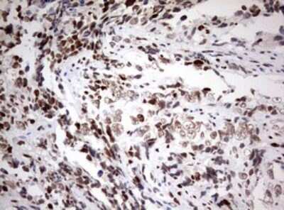 Immunohistochemistry: ZEB1 Antibody (OTI3G6) [NBP2-46398]
