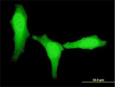 Immunocytochemistry/ Immunofluorescence: ZEB1 Antibody (4C4) [H00006935-M01]