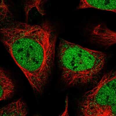 Immunocytochemistry/ Immunofluorescence: ZEB1 Antibody [NBP1-88845]