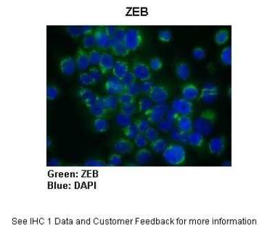 Immunohistochemistry: ZEB1 Antibody [NBP1-68930]