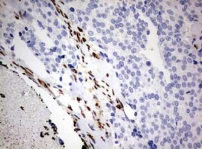 Immunohistochemistry: ZEB1 Antibody (OTI3G6) - Azide and BSA Free [NBP2-74910]