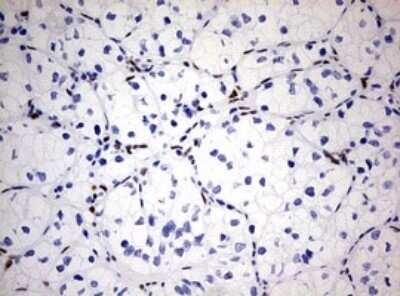 Immunohistochemistry: ZEB1 Antibody (OTI3G6) - Azide and BSA Free [NBP2-74910]