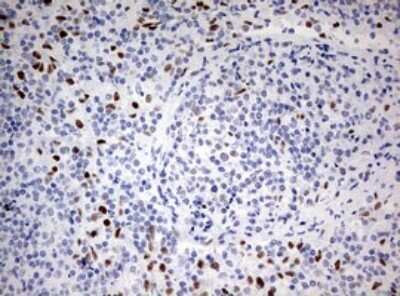 Immunohistochemistry: ZEB1 Antibody (OTI3G6) - Azide and BSA Free [NBP2-74910]