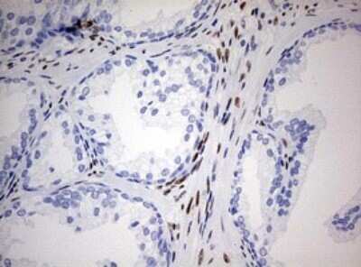 Immunohistochemistry: ZEB1 Antibody (OTI3G6) - Azide and BSA Free [NBP2-74910]