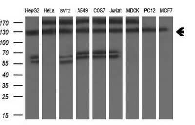 Western Blot: ZEB1 Antibody (OTI3G6)Azide and BSA Free [NBP2-74910]