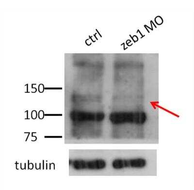 Western Blot: ZEB1 Antibody [NBP1-68930]