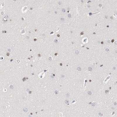 Immunohistochemistry-Paraffin: ZEB2 Antibody [NBP1-82991]
