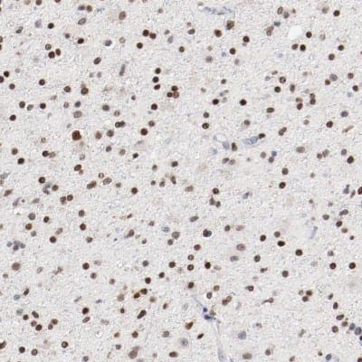Immunohistochemistry-Paraffin: ZEB2 Antibody [NBP1-82991]
