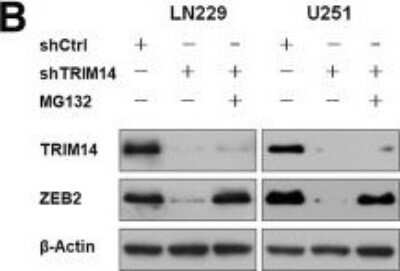 Western Blot: ZEB2 Antibody [NBP1-82991]