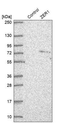 Western Blot: ZER1 Antibody [NBP2-33525]