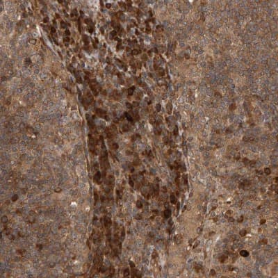 Immunohistochemistry-Paraffin: ZFAND1 Antibody [NBP1-82242]