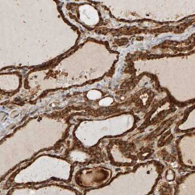 Immunohistochemistry-Paraffin: ZFAND1 Antibody [NBP1-82242]