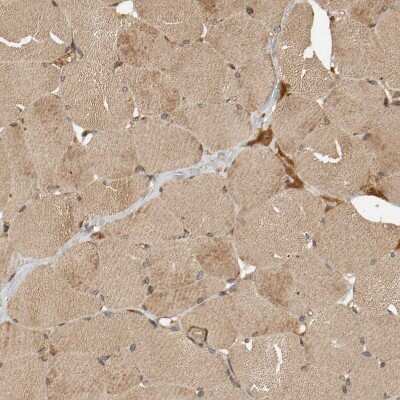 Immunohistochemistry-Paraffin: ZFAND1 Antibody [NBP1-82242]