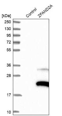 Western Blot: ZFAND2A Antibody [NBP1-90864]