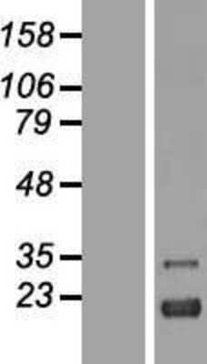 Western Blot: ZFAND2A Overexpression Lysate [NBP2-04855]