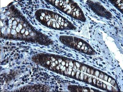 Immunohistochemistry: ZFAND3 Antibody (OTI1H10) [NBP2-46405]