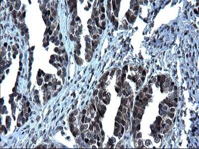 Immunohistochemistry: ZFAND3 Antibody (OTI1H10) [NBP2-46405]