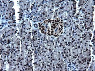 Immunohistochemistry: ZFAND3 Antibody (OTI1H10) [NBP2-46405]
