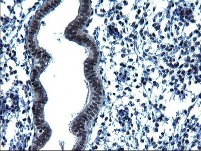 Immunohistochemistry: ZFAND3 Antibody (OTI1H10) [NBP2-46405]
