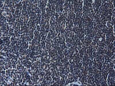 Immunohistochemistry: ZFAND3 Antibody (OTI1H10) [NBP2-46405]