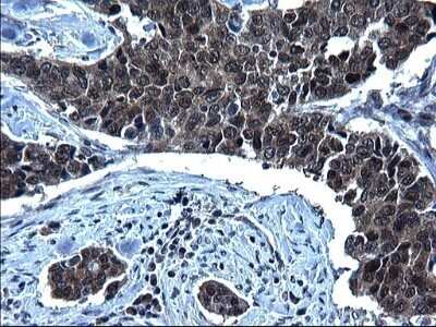 Immunohistochemistry: ZFAND3 Antibody (OTI1H10) - Azide and BSA Free [NBP2-74921]