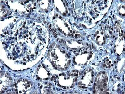 Immunohistochemistry: ZFAND3 Antibody (OTI1H10) - Azide and BSA Free [NBP2-74921]
