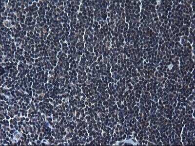 Immunohistochemistry: ZFAND3 Antibody (OTI1H10) - Azide and BSA Free [NBP2-74921]