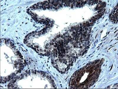Immunohistochemistry: ZFAND3 Antibody (OTI1H10) - Azide and BSA Free [NBP2-74921]