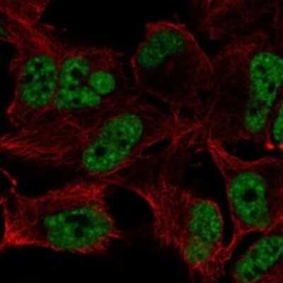 Immunocytochemistry/ Immunofluorescence: ZFAND5 Antibody [NBP3-17328]