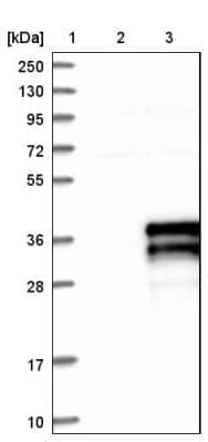 Western Blot: ZFAND5 Antibody [NBP1-80609]