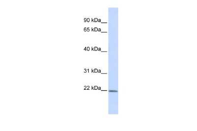Western Blot: ZFAND5 Antibody [NBP2-86413]