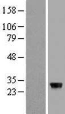 Western Blot: ZFAND5 Overexpression Lysate [NBL1-18014]