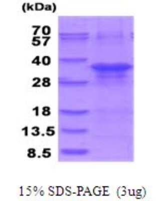SDS-PAGE: Recombinant Human ZFAND5 His Protein [NBP2-51938]