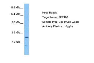 Western Blot: ZFP106 Antibody [NBP2-88617]