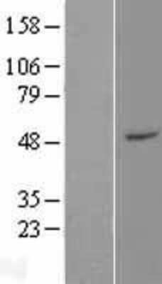 Western Blot: ZFP2 Overexpression Lysate [NBP2-06210]