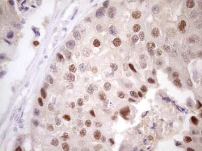 Immunohistochemistry: ZFP200 Antibody (OTI5F4) [NBP2-46423]