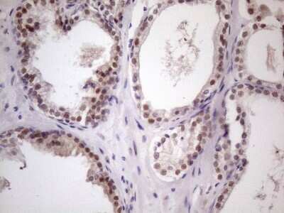 Immunohistochemistry: ZFP200 Antibody (OTI5F4) [NBP2-46423]