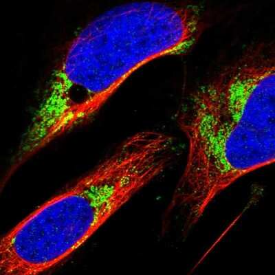 Immunocytochemistry/ Immunofluorescence: ZFP200 Antibody [NBP1-87460]
