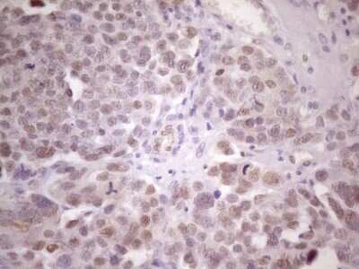 Immunohistochemistry: ZFP200 Antibody (OTI5F4) - Azide and BSA Free [NBP2-74923]