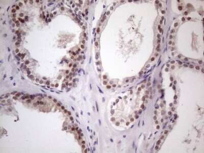 Immunohistochemistry: ZFP200 Antibody (OTI5F4) - Azide and BSA Free [NBP2-74923]