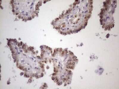 Immunohistochemistry: ZFP200 Antibody (OTI5F4) - Azide and BSA Free [NBP2-74923]