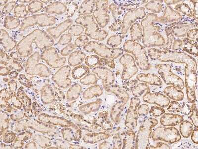 Immunohistochemistry: ZFP28 Antibody [NBP3-06636]