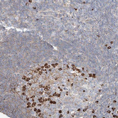 Immunohistochemistry-Paraffin: ZFP30 Antibody [NBP1-81455]