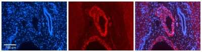 Immunohistochemistry-Paraffin: ZFP36L1 Antibody [NBP2-86906]