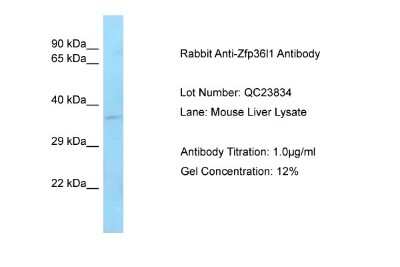 Western Blot: ZFP36L1 Antibody [NBP2-86907]