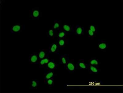 Immunocytochemistry/ Immunofluorescence: ZFP37 Antibody [H00007539-B01P]