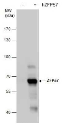 Western Blot: ZFP57 Antibody (865) [NBP2-43813]
