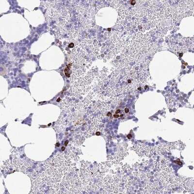 Immunohistochemistry-Paraffin: ZFP62 Antibody [NBP2-13547]