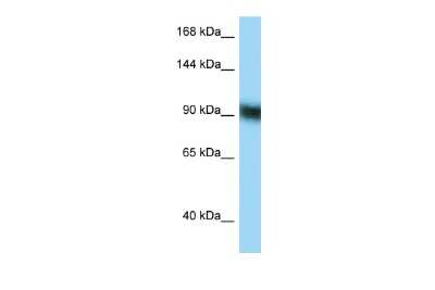 Western Blot: ZFP62 Antibody [NBP2-86416]